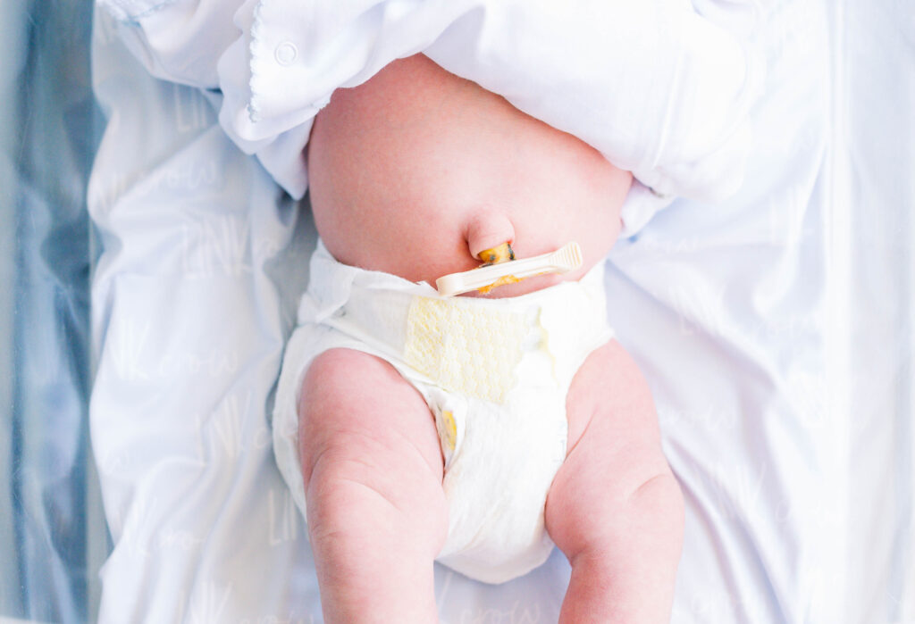A 
Fresh 48 Session captures a photograph of a newborn's belly button while the baby lies in a bassinet in the hospital room. 